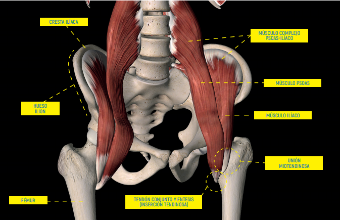 LESIÓN DEL MÚSCULO PSOAS-ILÍACO 13 psoas